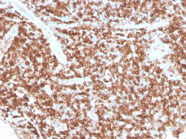 Recombinant CD74 (B-Cell Marker) Antibody