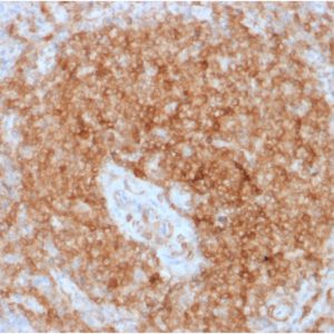 Formalin-fixed, paraffin-embedded human Spleen stained with CD79a Mouse Recombinant Monoclonal Antibody (rIGA/764).