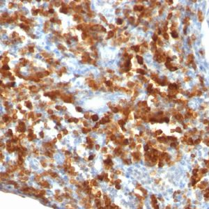Formalin-fixed, paraffin-embedded human lymphoma stained with CD79a Mouse Monoclonal Antibody (IGA/515).