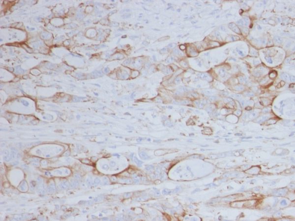 Formalin-fixed, paraffin-embedded human colon stained with CD151 Mouse Monoclonal Antibody (11G5a).