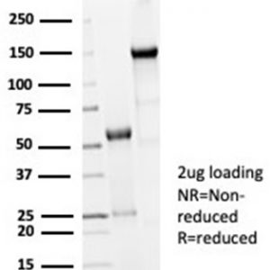 SDS-PAGE Analysis of Purified CDC20 Recombinant Rabbit Monoclonal Antibody (CDC20/7026R). Confirmation of Purity and Integrity of Antibody.