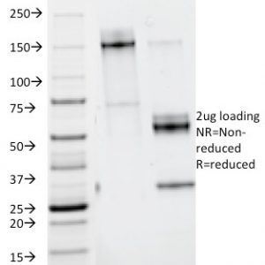 SDS-PAGE Analysis of Purified Nidogen Mouse Monoclonal Antibody (ELM1). Confirmation of Purity and Integrity of Antibody.