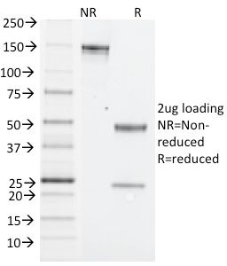 SDS-PAGE Analysis of Purified NK1.1 Mouse Monoclonal Antibody (PK136). Confirmation of Integrity and Purity of Antibody.