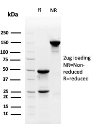 SDS-PAGE Analysis of Purified Myofibroblast Marker Mouse Monoclonal Antibody (PR 2D3). Confirmation of Purity and Integrity of Antibody.