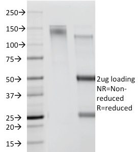 SDS-PAGE Analysis of Purified CDw78 Monoclonal Antibody (DF1588). Confirmation of Purity and Integrity of Antibody.