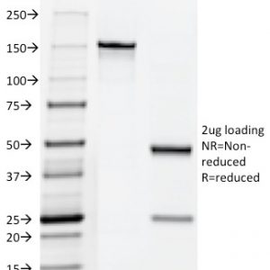 SDS-PAGE Analysis of Purified hCG Mouse Monoclonal Antibody (HCGab/52). Confirmation of Purity and Integrity of Antibody.