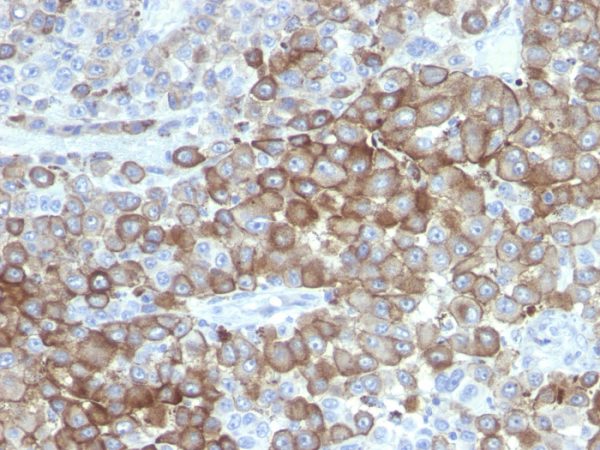 PNL2 (Melanoma Associated Antigen) Antibody