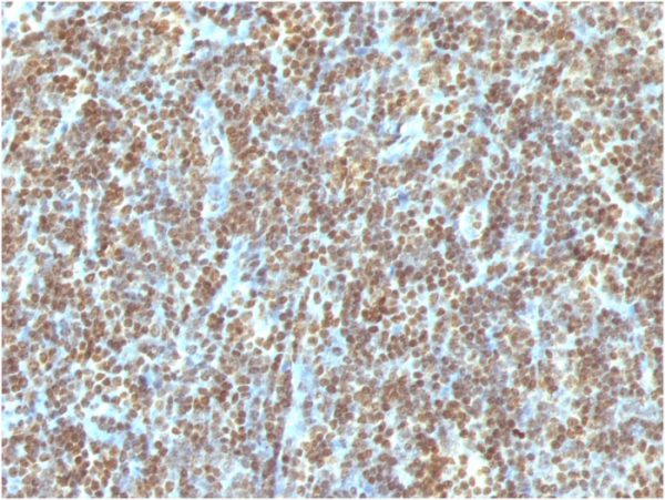 Formalin-fixed, paraffin-embedded human Tonsil stained with Double Stranded DNA Mouse Monoclonal Antibody (121-3)