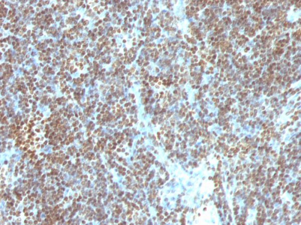 Formalin-fixed, paraffin-embedded human Tonsil stained with Double Stranded DNA Monoclonal Antibody (SPM603)