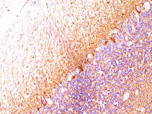 Formalin-fixed, paraffin-embedded human Cerebellum stained with Neurofilament Monoclonal Antibody (RT-97 + NR-4).