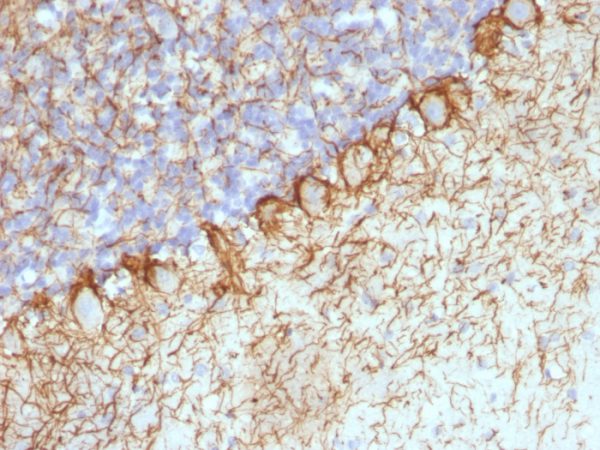 Formalin-fixed, paraffin-embedded Rat Cerebellum stained with Neurofilament Monoclonal Antibody (RT-97 + NR-4).