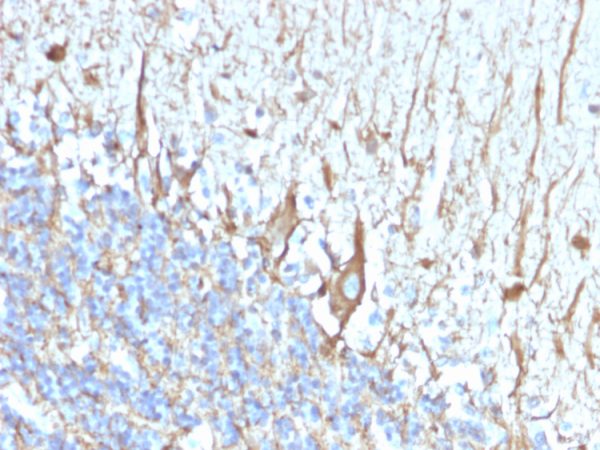 Neurofilament (H+L) (Neuronal Marker) Antibody