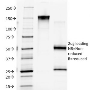 SDS-PAGE Analysis of Purified Macrophage Monoclonal Antibody (D11). Confirmation of Purity and Integrity of Antibody.