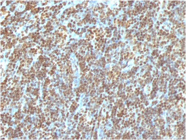 Formalin-fixed, paraffin-embedded human Tonsil stained with Double Stranded DNA Mouse Monoclonal Antibody (AE-2)