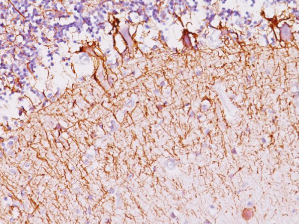 Formalin-fixed, paraffin-embedded human Cerebellum stained with Neurofilament Monoclonal Antibody (SPM145).