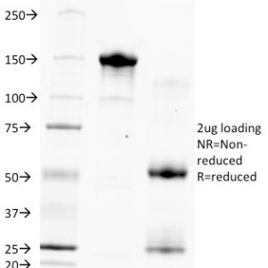 SDS-PAGE Analysis of Purified Hepatocyte Specific Antigen Monoclonal Antibody (HSA133). Confirmation of Purity and Integrity of Antibody.