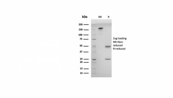 SDS-PAGE Analysis of Purified Double Stranded DNA Mouse Monoclonal Antibody (DSD/958). Confirmation of Purity and Integrity of Antibody.