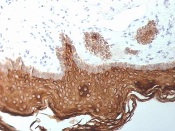 Formalin-fixed, paraffin-embedded human Skin stained with Cytokeratin, 5/6/18 Mouse Monoclonal Antibody (SPM267).