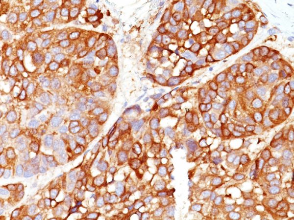 Melanoma Marker (MART-1 + Tyrosinase + gp100) Antibody