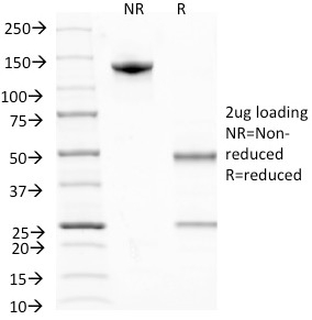 SDS-PAGE Analysis of Purified BrdU Monoclonal Antibody (MoBu-1). Confirmation of Purity and Integrity of Antibody.