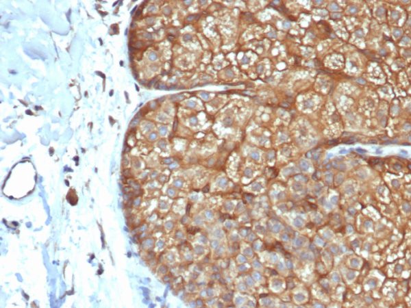 Formalin-fixed, paraffin-embedded human sebaceous gland stained with CK Type I Recombinant Mouse Monoclonal Antibody (rKRTL/6616).