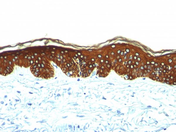 Cytokeratin, Basic (Type II or HMW) (Epithelial Marker) Antibody