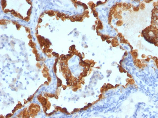 Cytokeratin 8/18 Antibody