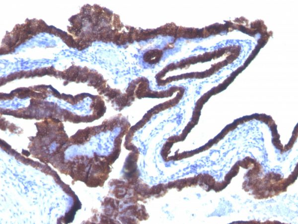 Cytokeratin 8/18 Antibody - Image 2