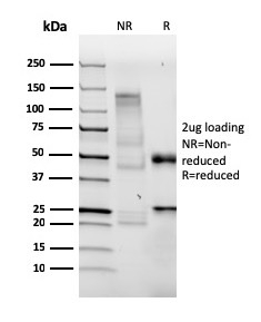 SDS-PAGE Analysis of Purified BrdU Recombinant Rabbit Monoclonal (BRDU/3902R). Confirmation of Purity and Integrity of Antibody.