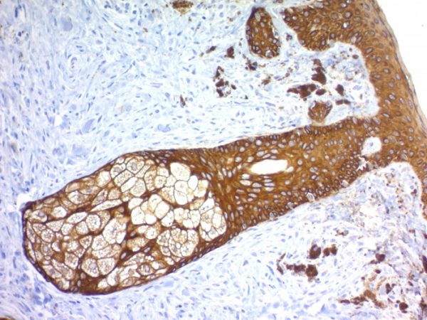 Formalin-fixed, paraffin-embedded human Skin stained with Cytokeratin, HMW Rabbit Recombinant Monoclonal Antibody (KRTH/1576R).