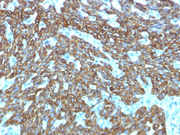 Formalin-fixed, paraffin-embedded human Skin stained with Cytokeratin, HMW Rabbit Recombinant Monoclonal Antibody (KRTH/1576R).