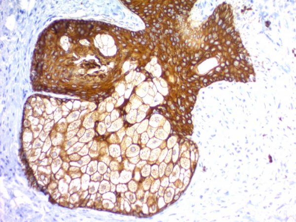 Recombinant Cytokeratin, pan (Epithelial Marker) Antibody