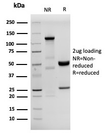 SDS-PAGE Analysis of Purified HHV8 Recombinant Rabbit Monoclonal Antibody (HHV8/3633R). Confirmation of Purity and Integrity of Antibody.