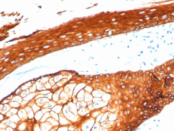 Recombinant Cytokeratin, Type II (Epithelial Marker) Antibody