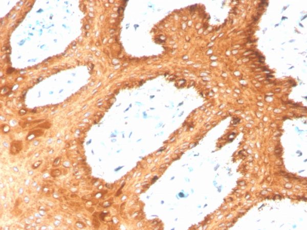 Recombinant Cytokeratin, Type II (Epithelial Marker) Antibody - Image 2