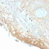 Recombinant HPV-16 (Human Papilloma Virus 16) Antibody