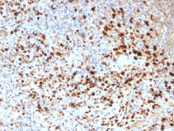 HSV1 (Herpes Simplex Virus Type I) Antibody