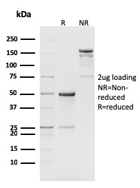 SDS-PAGE Analysis of Purified CD8b Rat Monoclonal Antibody (H35-17.2). Confirmation of Integrity and Purity of Antibody.