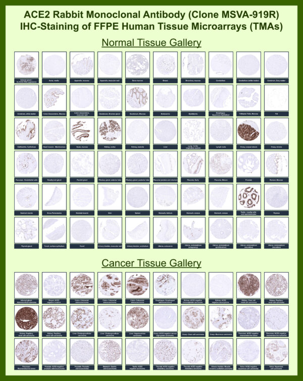 ACE2 Antibody in Immunohistochemistry (IHC (P))