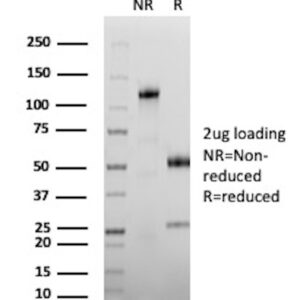 CEA Antibody in SDS-PAGE