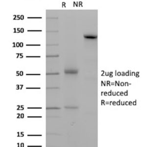 Desmoglein-2 Antibody in SDS-PAGE