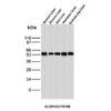 ALDH1A1 Antibody in Western Blot (WB)