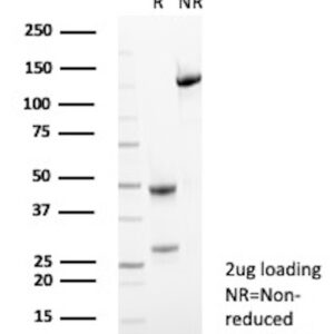 Alkaline Phosphatase Antibody in SDS-PAGE