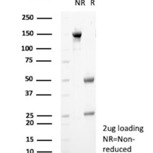 GnRH-Receptor Antibody in SDS-PAGE