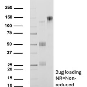 CD13 Antibody in SDS-PAGE