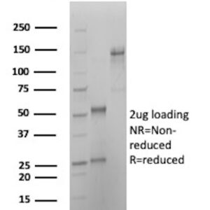 HLA-B Antibody in SDS-PAGE