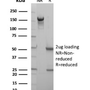 HLA-DQA Antibody in SDS-PAGE