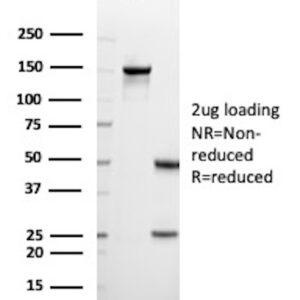 HLA-DRB Antibody in SDS-PAGE