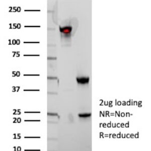 IGHA Antibody in SDS-PAGE