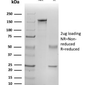 IL-1 beta Antibody in SDS-PAGE